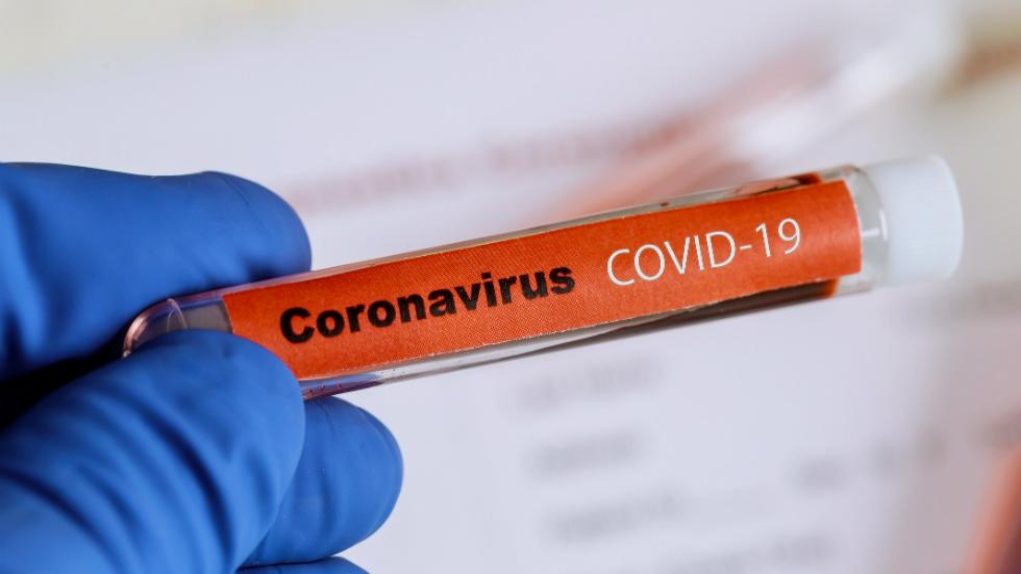 coronavirus-koronoios-1021x574-19 Αν. Μακεδονία-Θράκη: 219 νέες μολύνσεις SARS-COV 2 – Αναλυτικοί πίνακες