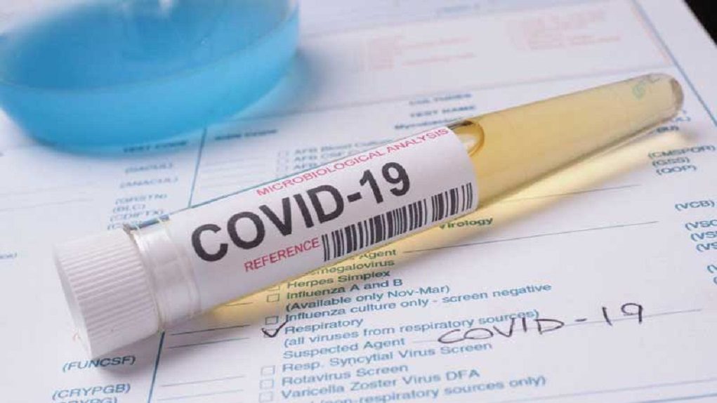 covid-test1-1021x574-1 Κορονοϊός: 32 νέα κρούσματα της βρετανικής μετάλλαξης στην Ελλάδα